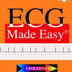 ECG Made Easy