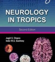 Neurology in Tropics