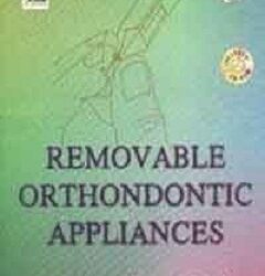 Removable Orthondontic Appliances