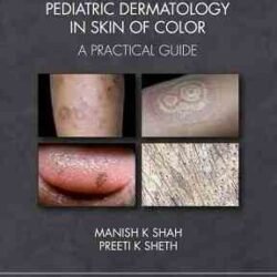 Pediatric Dermatology in Skin of Color