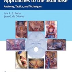 Microsurgical And Endoscopic Approaches To The Skull Base