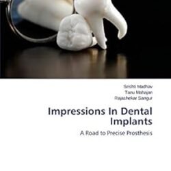 Impressions In Dental Implants