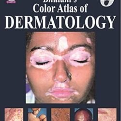 Bhutanis Color Atlas Of Dermatology