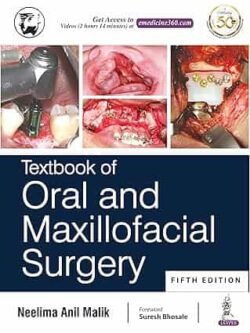 Textbook Of Oral And Maxillofacial Surgery