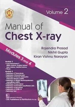 Manual Of Chest X-Ray Modules 3 And 4 Volume 2