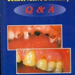 Guidebook On Preclinical Conservative Dentistry Q And A