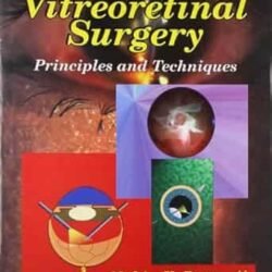 Vitreoretinal Surgery Principles And Techniques