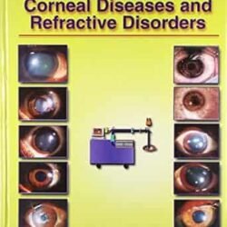 Excimer Lasers In Corneal Diseases And Refractive Disorders