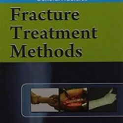Fracture Treatment Methods
