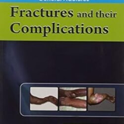 Fractures And Their Complications