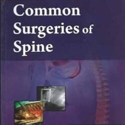 Common Surgeries Of Spine