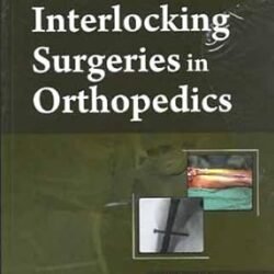 Interlocking Surgeries In Orthopedics