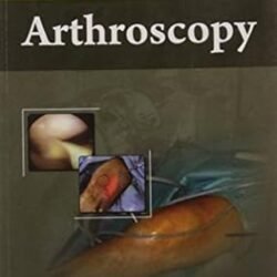 Arthroscopy