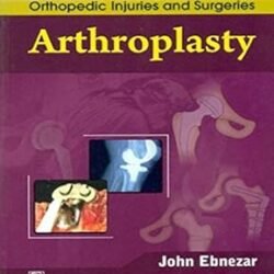 Arthroplasty