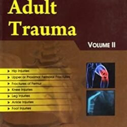 Adult Trauma Volume 2