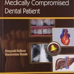 Management Of Medically Compromised Dental Patient