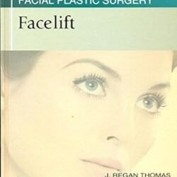 Facelift