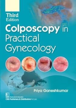 Colposcopy In Practical Gynecology