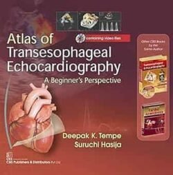 Atals Of Transesophageal Echocardiography A Beginners Perspective