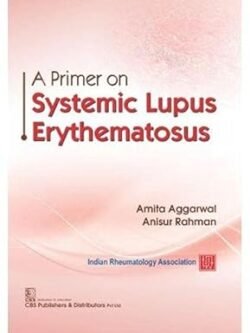 A Primer On Systemic Lupus Erythematosus