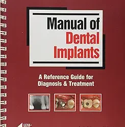 Manual of Dental Implants: A Reference Guide for Diagnosis & Treatment