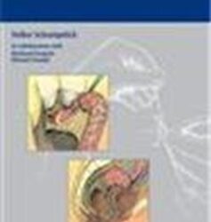 Atlas of General Surgery