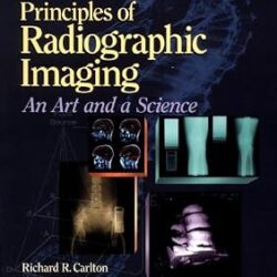 Principles Of Radiographic Imaging,