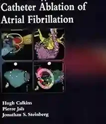 A Practical Approach To Catheter Ablation Of Atrial Fibrillation