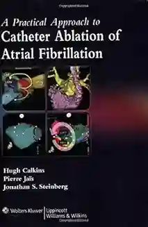 A Practical Approach To Catheter Ablation Of Atrial Fibrillation