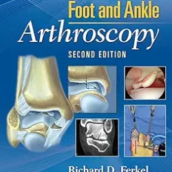 Foot And Ankle Arthroscopy 2Ed