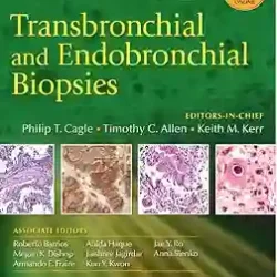 Transbronchial And Endobronchial Biopsies 2009