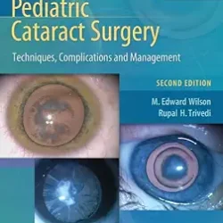 Pediatric Cataract Surgery: Techniques, Complications And Management 2Ed