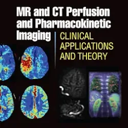 Mr And Ct Perfusion And Pharmacokinetic Imaging Clinical Applications And Theory