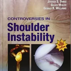 Controversies In Shoulder Instability