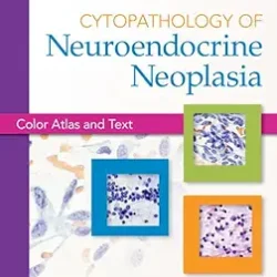 Cytopathology Of Neuroendocrine Neoplasia