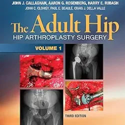 The Adult Hip Arthroplasty Surgery And Its Alternatives 2 Vol Set 3Ed