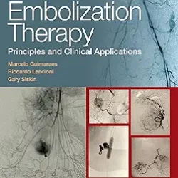 Embolization Therapy Principles And Clinical Applications