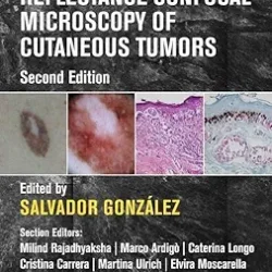 Reflectance Confocal Microscopy Of Cutaneous Tumors 2Ed