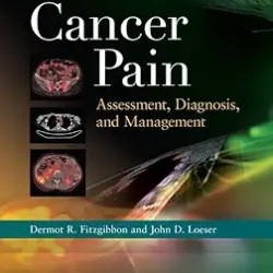 Cancer Pain: Assessment, Diagnosis, And Management
