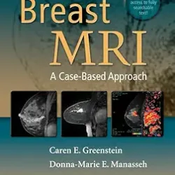 Breast Mri A Case Based Approach