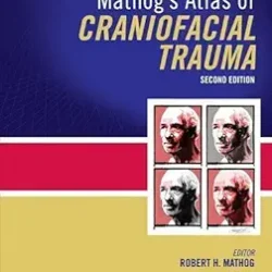 Mathog Atlas Of Craniofacial Trauma 2Ed