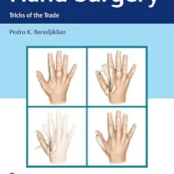 Hand Surgery Tricks Of The Trade With Access Code