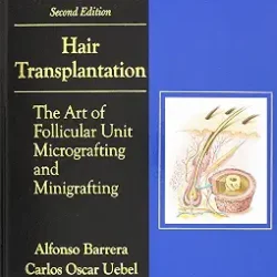 Hair Transplantation The Art Of Follicular Unit Micrografting And Minigrafting 2Ed