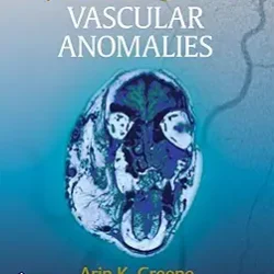 Operative Management Of Vascular Anomalies