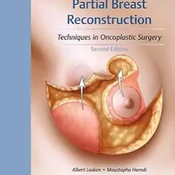 Partial Breast Reconstruction Techniques In Oncoplastic Surgery 2Ed