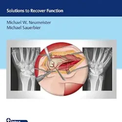Problems In Hand Surgery Solutions To Recover Function