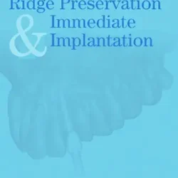 Ridge Preservation And Immediate Implantation