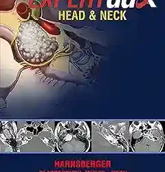 Expert Ddx Head And Neck