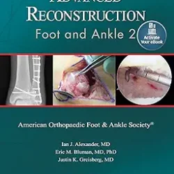 Advanced Reconstruction Foot And Ankle 2