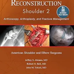 Advanced Reconstruction Shoulder 2 Arthroscopy Arthroplasty And Fracture Management